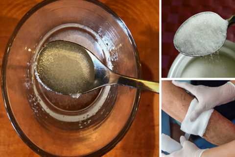 How To Treat And Heal Wounds With Sugar